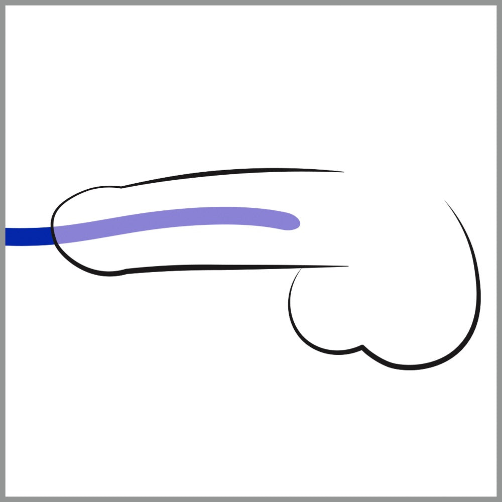 You2Toys Silikon-Dilator-Set 3-teilig für die Harnröhre